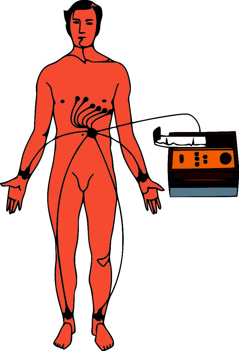 12 Lead Ekg Clipart