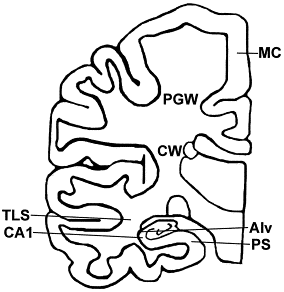 Microglial Expression of MHC Class II Increases in Normal Aging of ...