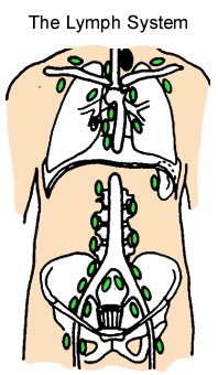 lymphoma_diagram.gif