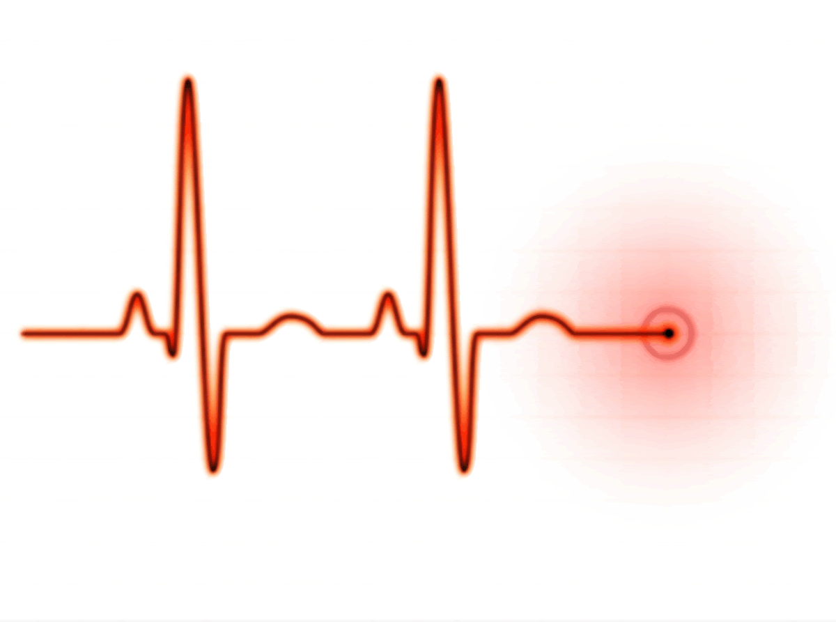 Ekg Strip Clipart