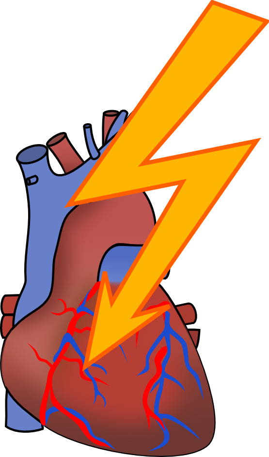 Clip Art: Heart Attack August 2011 Clip Art SVG ...