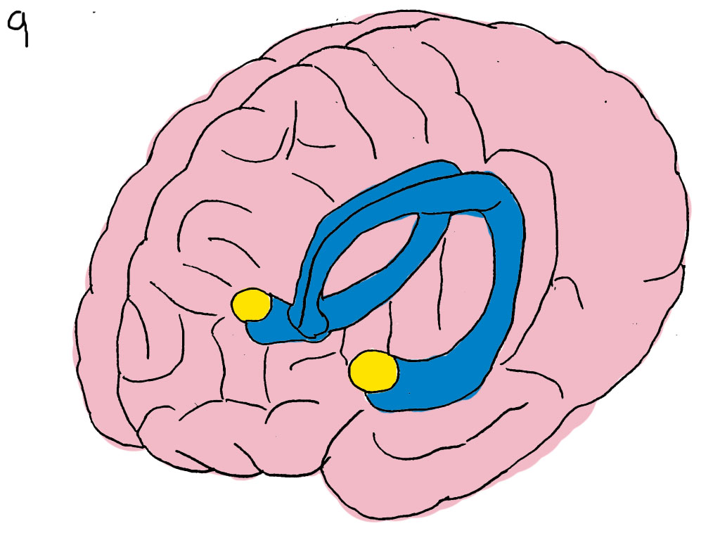 amygdala | Transcend the Systems