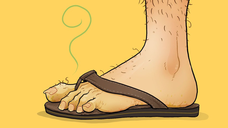 Guys, it's never ever OK to wear open-toed sandals
