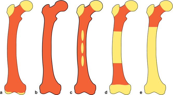 Musculoskeletal System | Radiology Key