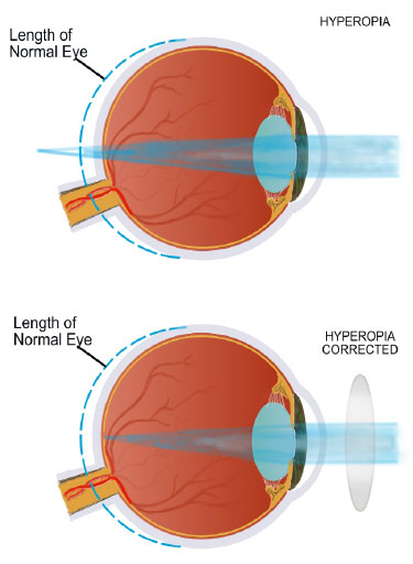 sjesci - light and sight