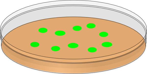 Orange Petri Dish With Greeen Bacterial Colonies Clip Art at Clker ...