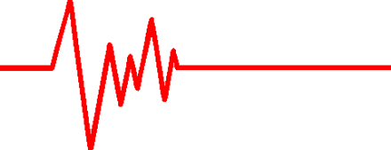 Ekg Strip Clipart