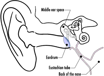 Ear Tubes - Children's ENT and Facial Plastic Surgery, Minneapolis, MN