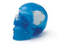 Skull Reshaping in Indianapolis - Eppley Plastic Surgery