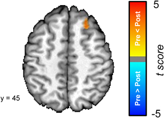 Frontiers | Resting-state connectivity of the amygdala is altered ...