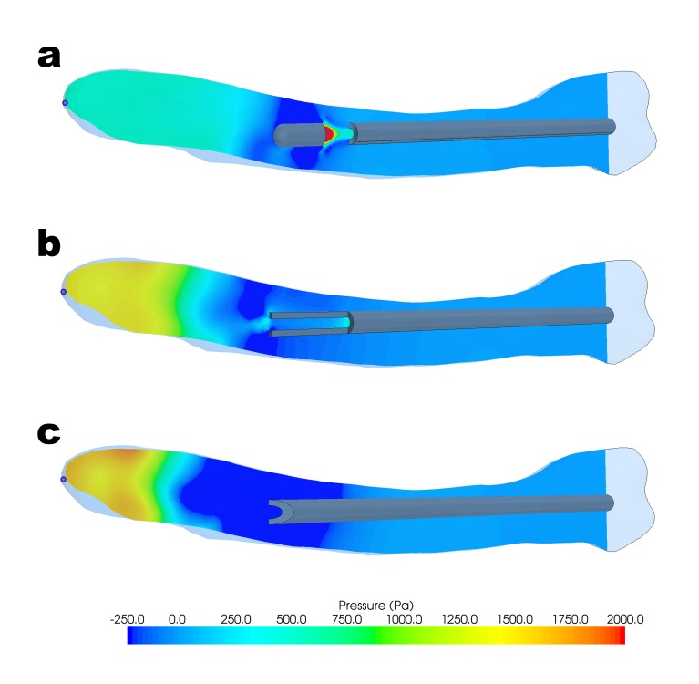 Visualization of the irrigant hydrostatic pressure distribution in ...