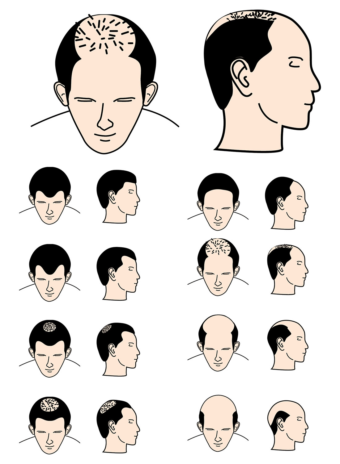 Hair loss: 10 things you need to know | Expat Living Hong Kong