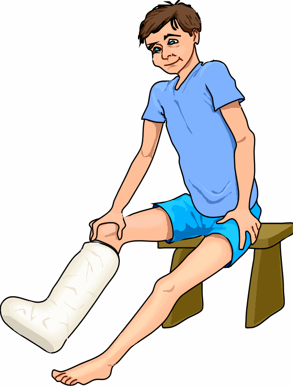 Broken Leg Cartoons ClipArt Best