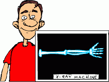 X ray clipart