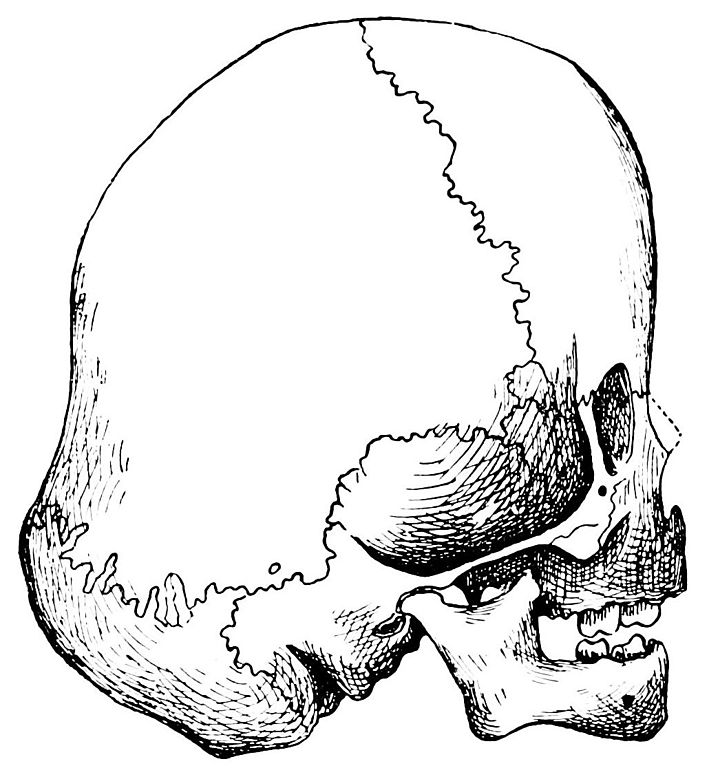 PSM V39 D553 Right lateral aspect of the navajo child skull ...