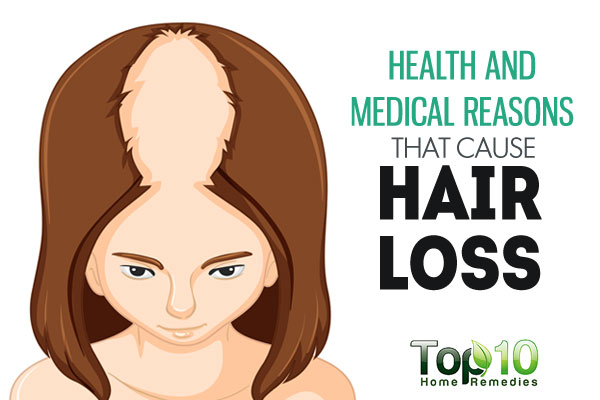 10 Health and Medical Reasons that Cause Hair Loss | Top 10 Home ...