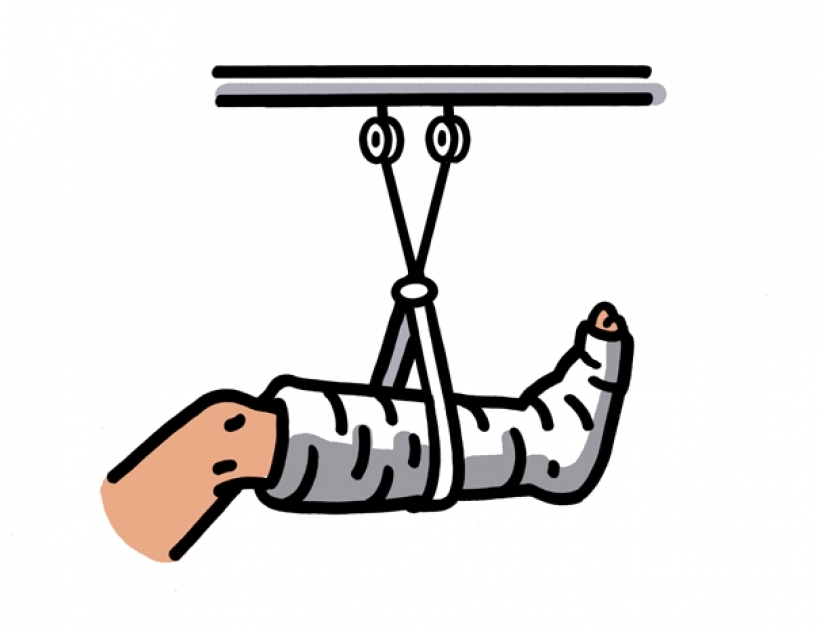 Broken foot clipart leg - Clipartix