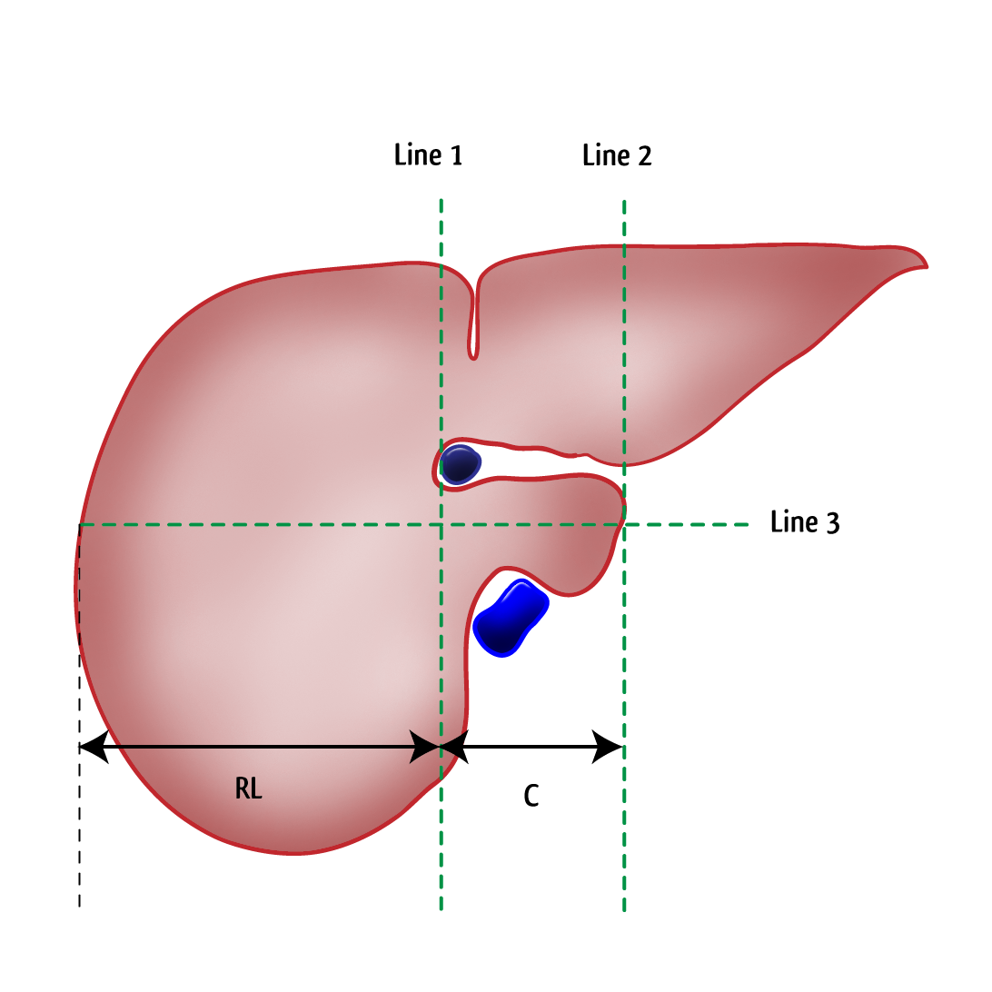 Abdomen Diagram Male - ClipArt Best