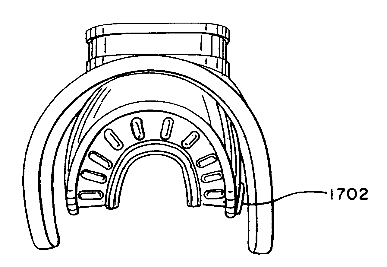 Anatomical mouthpiece with retaining wings system and method ...