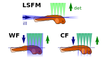 Light sheet fluorescence microscopy