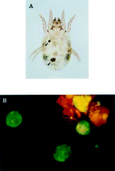 Feces of Dermatophagoides farinae . A live house dust mite ...