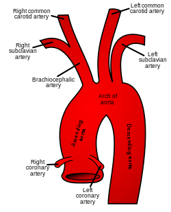 Aortic arch