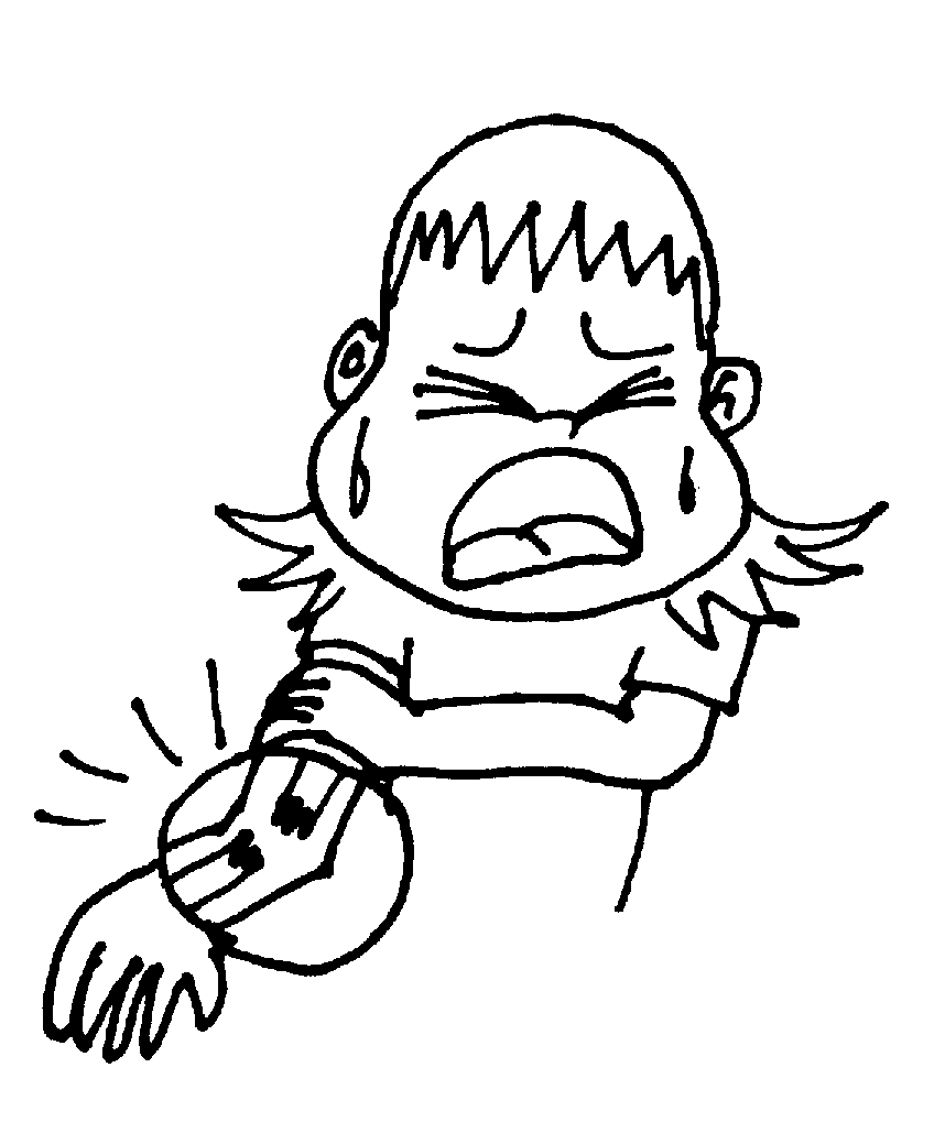 Clipart broken arm